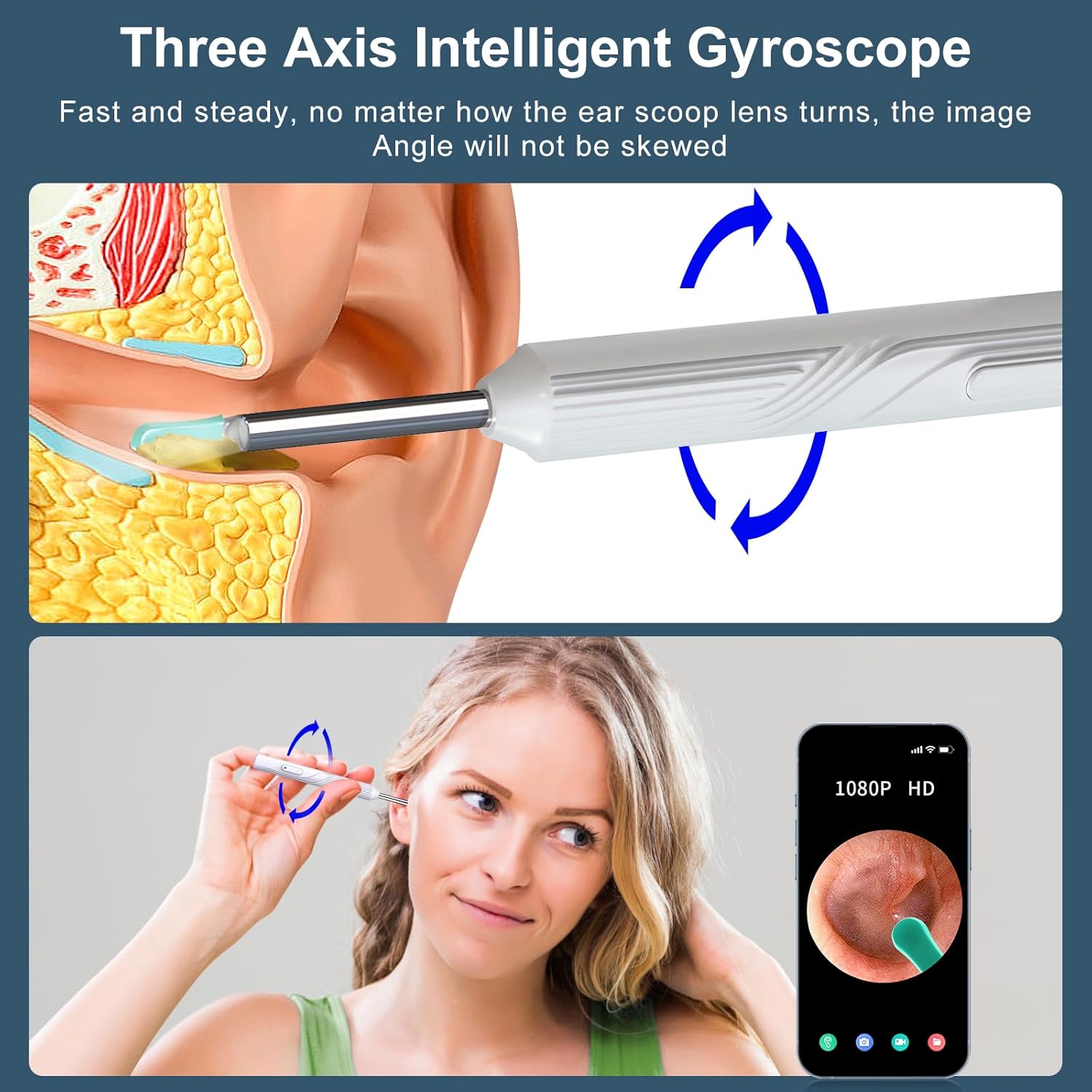 Otoscopio Limpiador Oidos Luz Camara HD