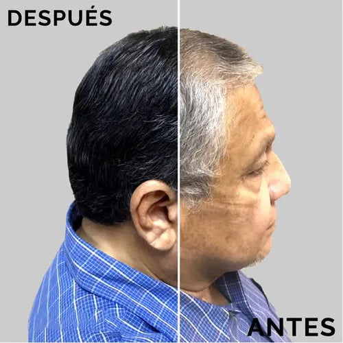 DexeCover® Shampoo Cubre Canas Orgánico Dexe