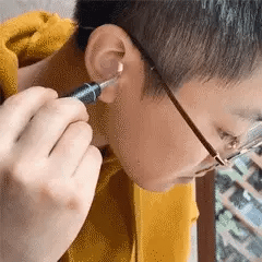 Otoscopio Limpiador Oidos Luz Camara HD