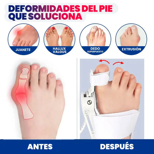 OrthoFit® CORRECTOR JUANETES + PLANTILLA ORTESIS